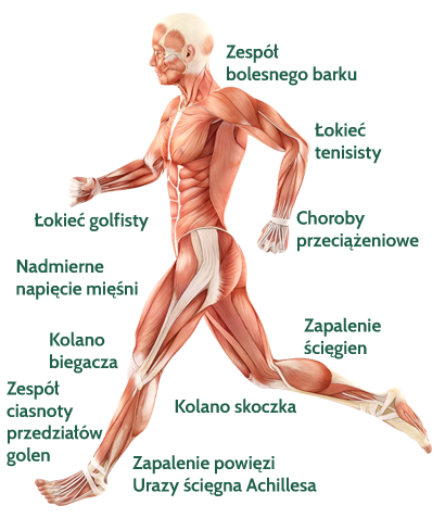 Rehabilitacja urazów sportowych